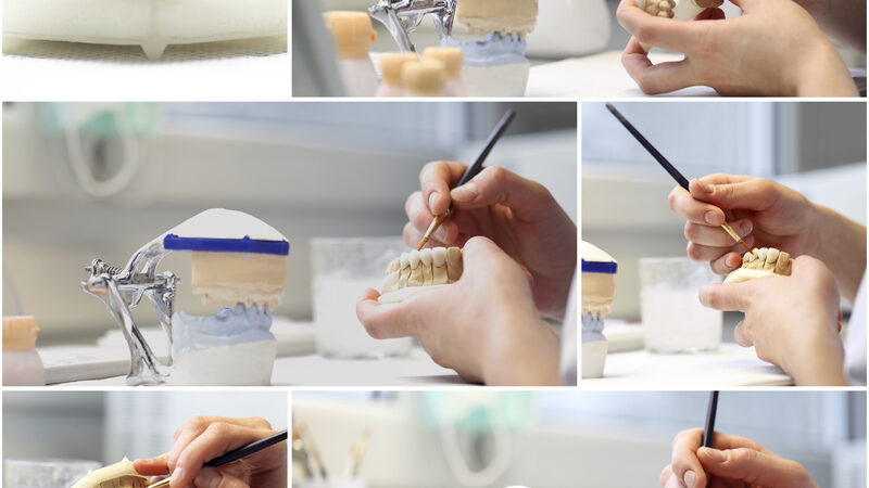 Få kvalitetsproteser i Polen